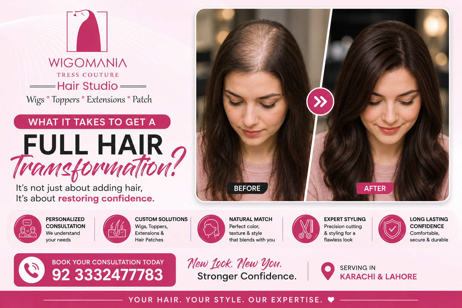 What It Takes to Get a Full Hair Transformation?