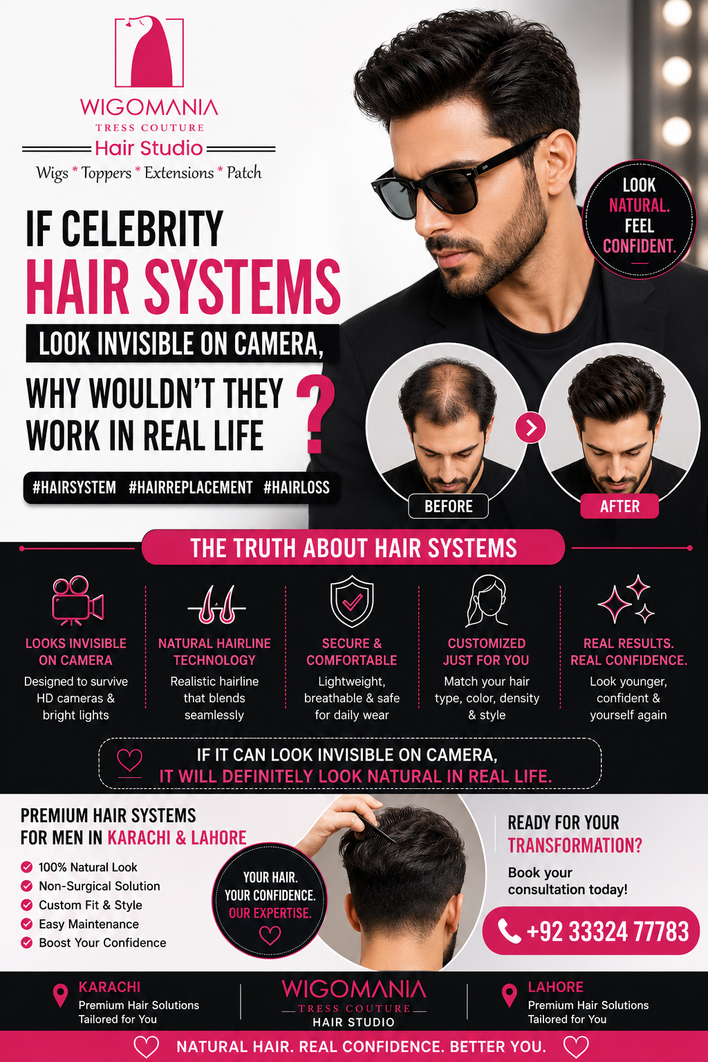 If Celebrity Hair Systems Look Invisible on Camera, Why Wouldn’t They Work in Real Life?