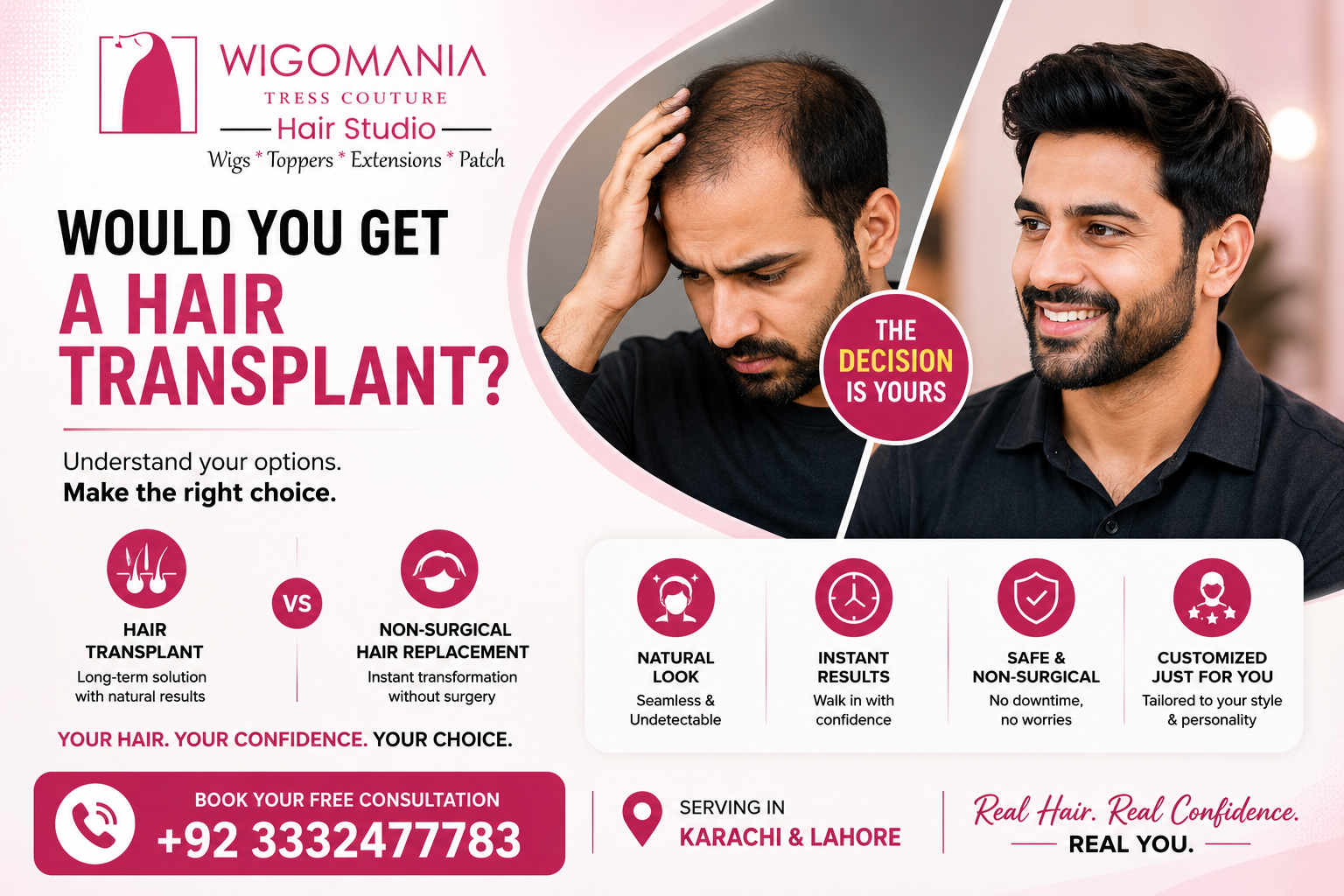 Would You Get a Hair Transplant? Here’s What Karachi & Lahore Should Know Before Deciding