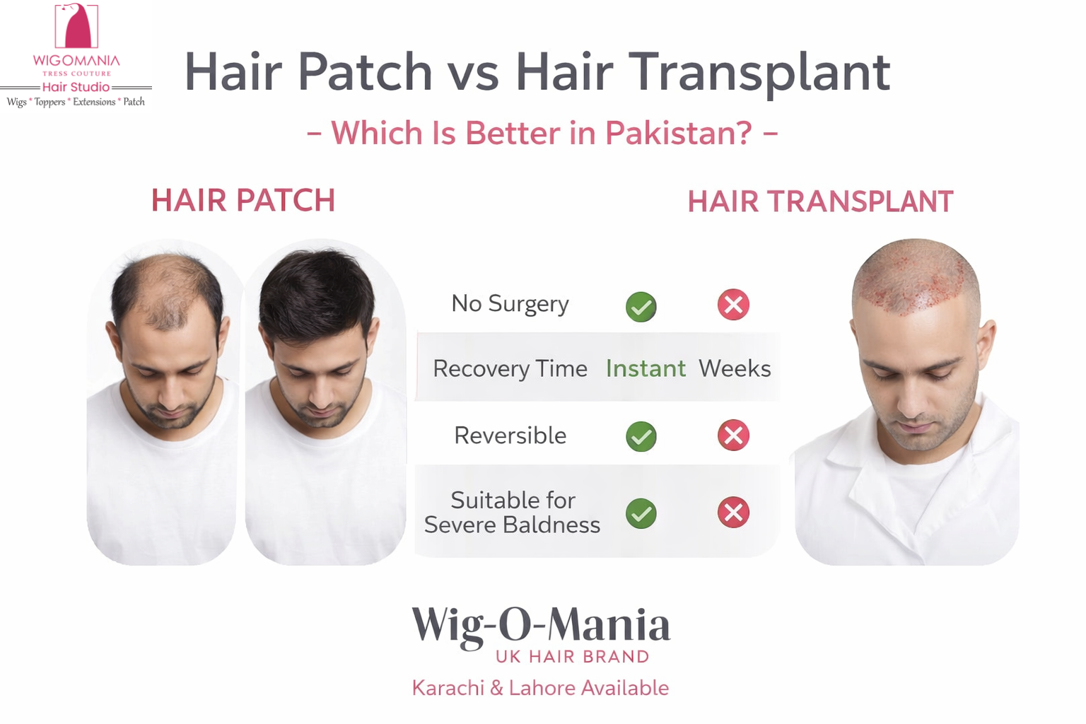 Hair Patch vs Hair Transplant – Which Is Better in Pakistan?