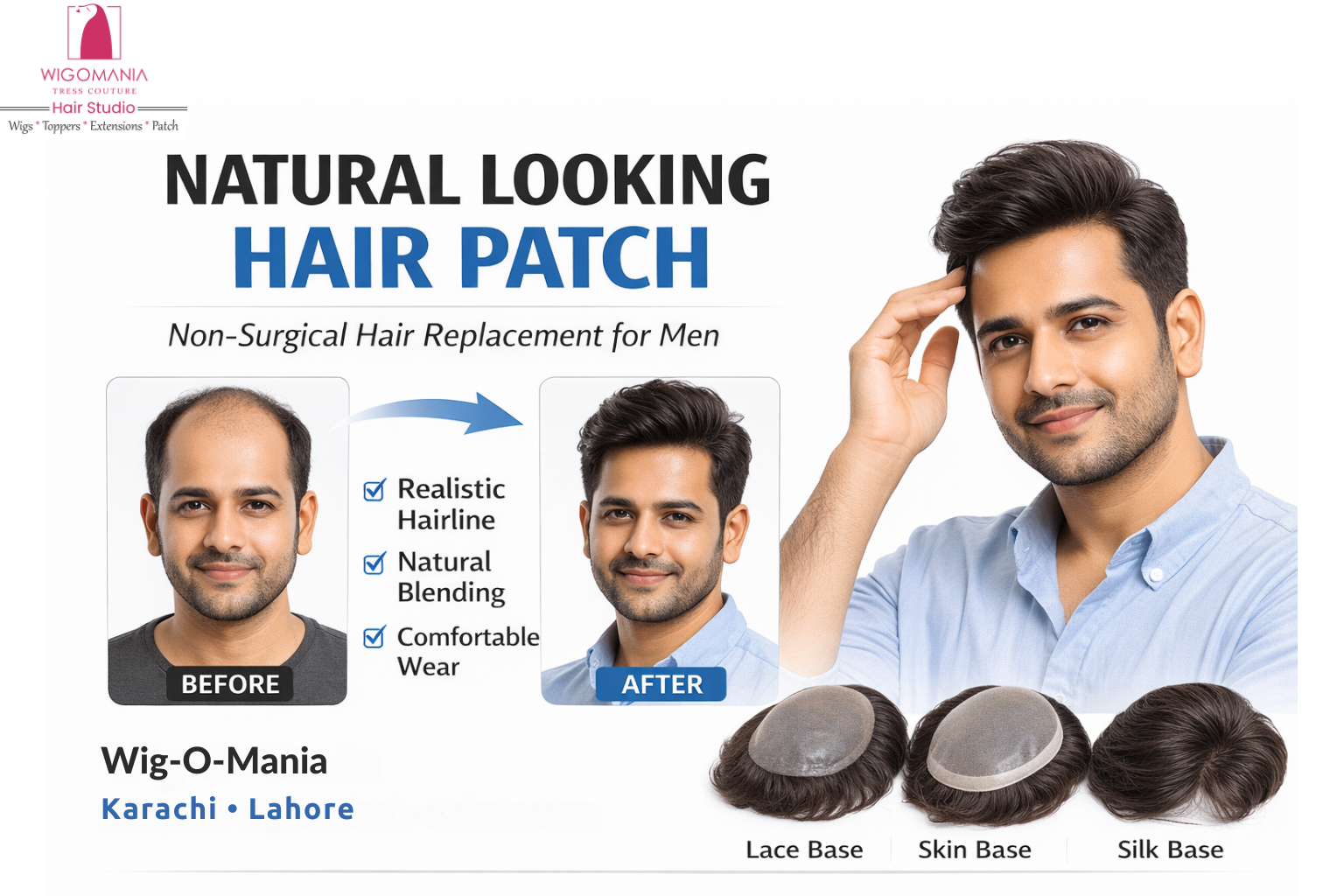 Natural Looking Hair Patch in Karachi & Lahore: A Practical Guide for Men Who Want Instant Confidence